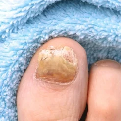 Clearance Tempsl Teinture pour Onyxis Titania®, 10 ml